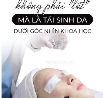 Peel da trị n&aacute;m tại spa | Peel da gi&aacute; rẻ H&agrave; Nội