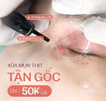 Đốt mụn thịt &ndash; nốt ruồi an to&agrave;n gi&aacute; rẻ tại H&agrave; Nội