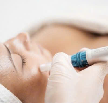 Chăm S&oacute;c Da Mụn Cơ Bản &ndash; 45 ph&uacute;t