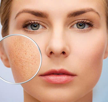 Phục Hồi Da Bằng HA &ndash; Cấp Ẩm S&acirc;u & Căng Mướt (90 ph&uacute;t)