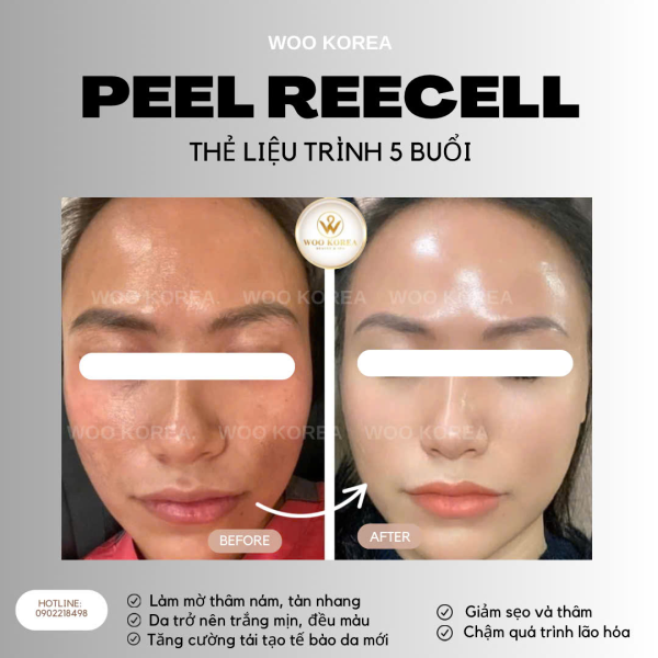 Tin tức hữu &iacute;ch