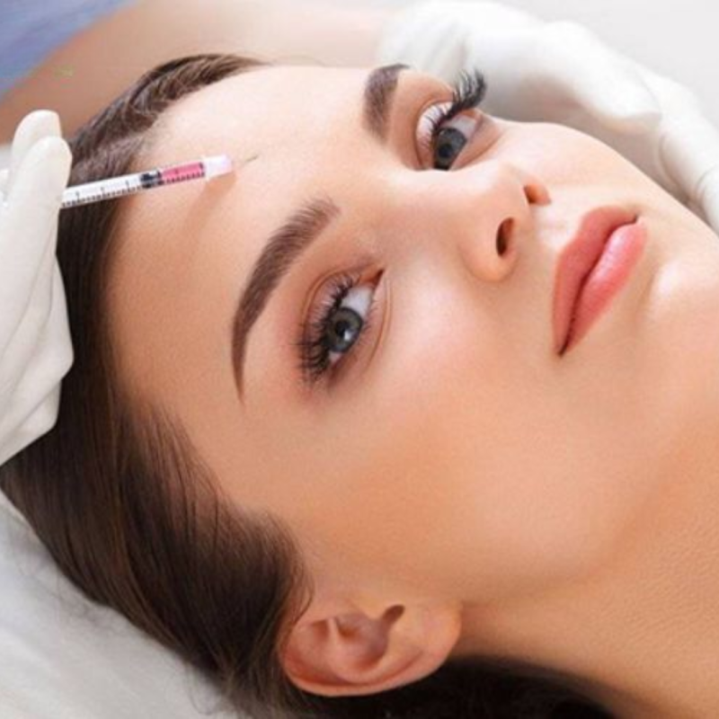 Cấy tế bào gốc + HA (1h30p)