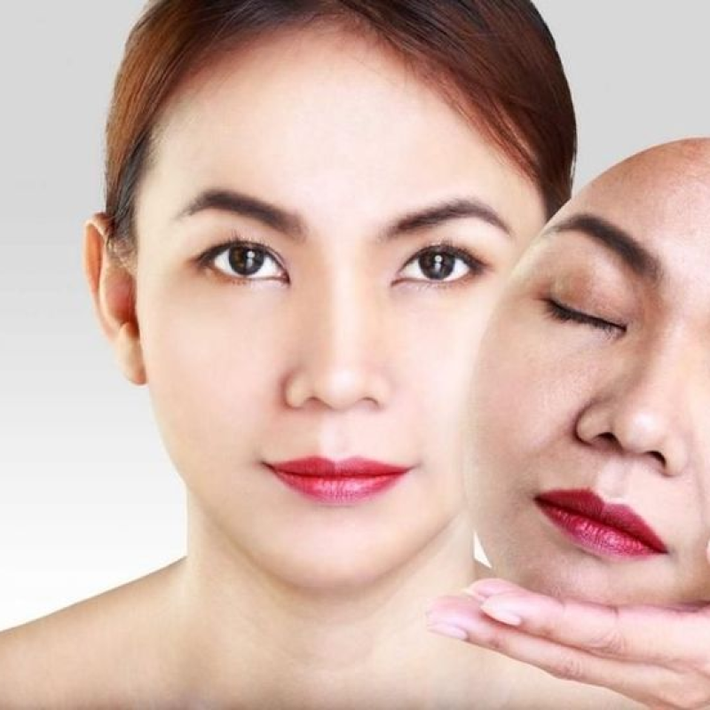 Meso Cleopatra Nâng cơ cấp độ 4 (1h30p)