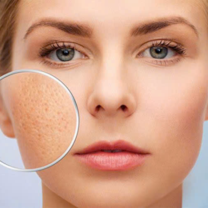 Phục Hồi Da Bằng HA &ndash; Cấp Ẩm S&acirc;u & Căng Mướt (90 ph&uacute;t)