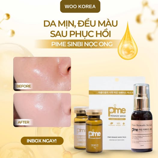 da xỉn màu
