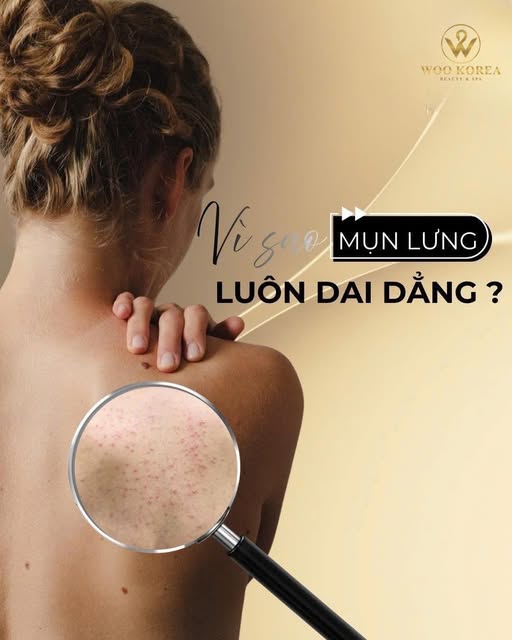 mụn lưng