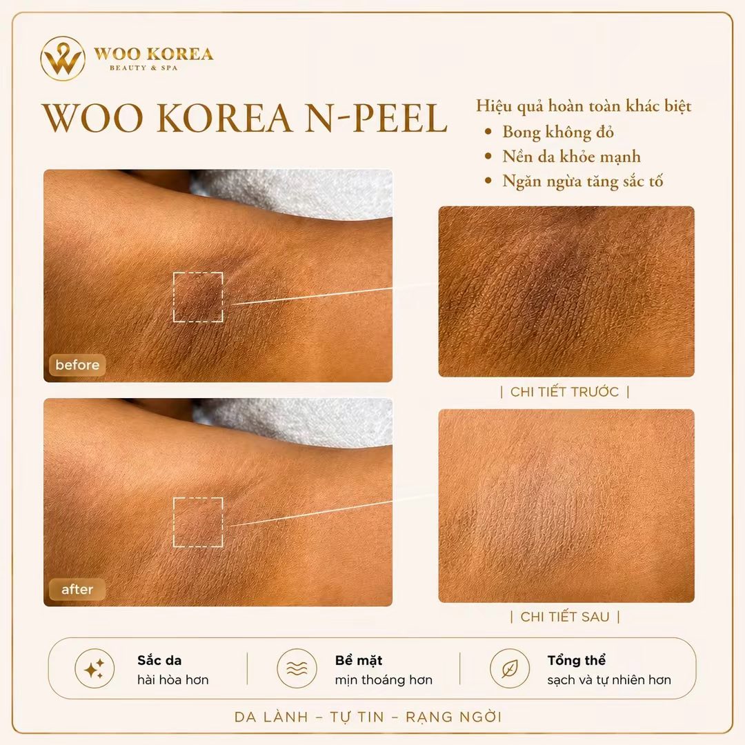 peel da trị thâm nách
