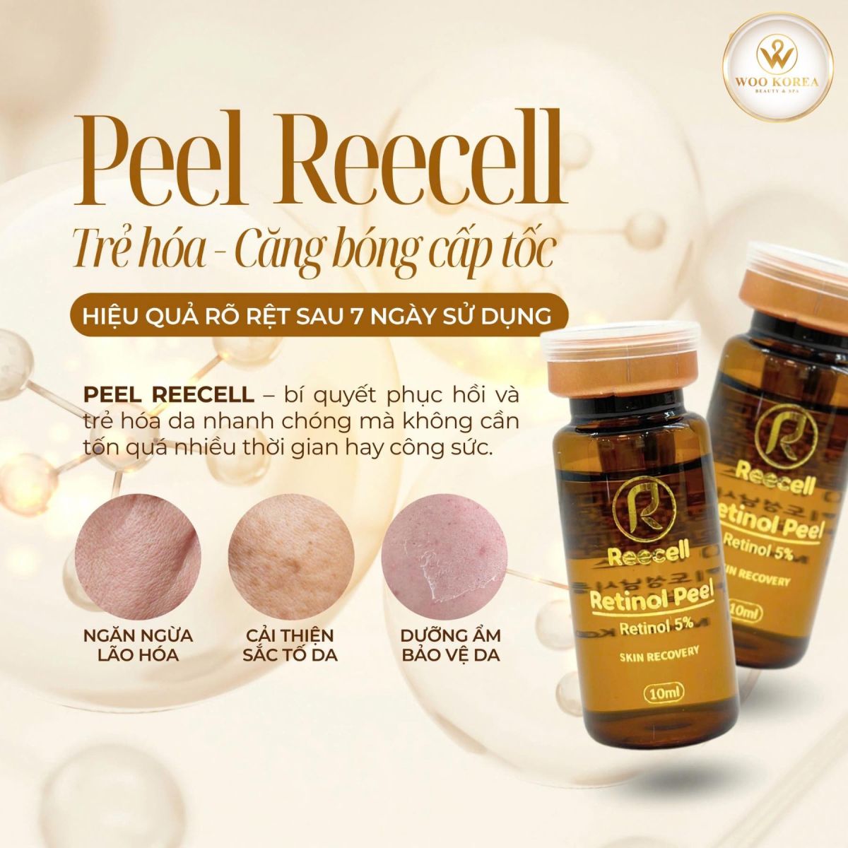 peel reecell