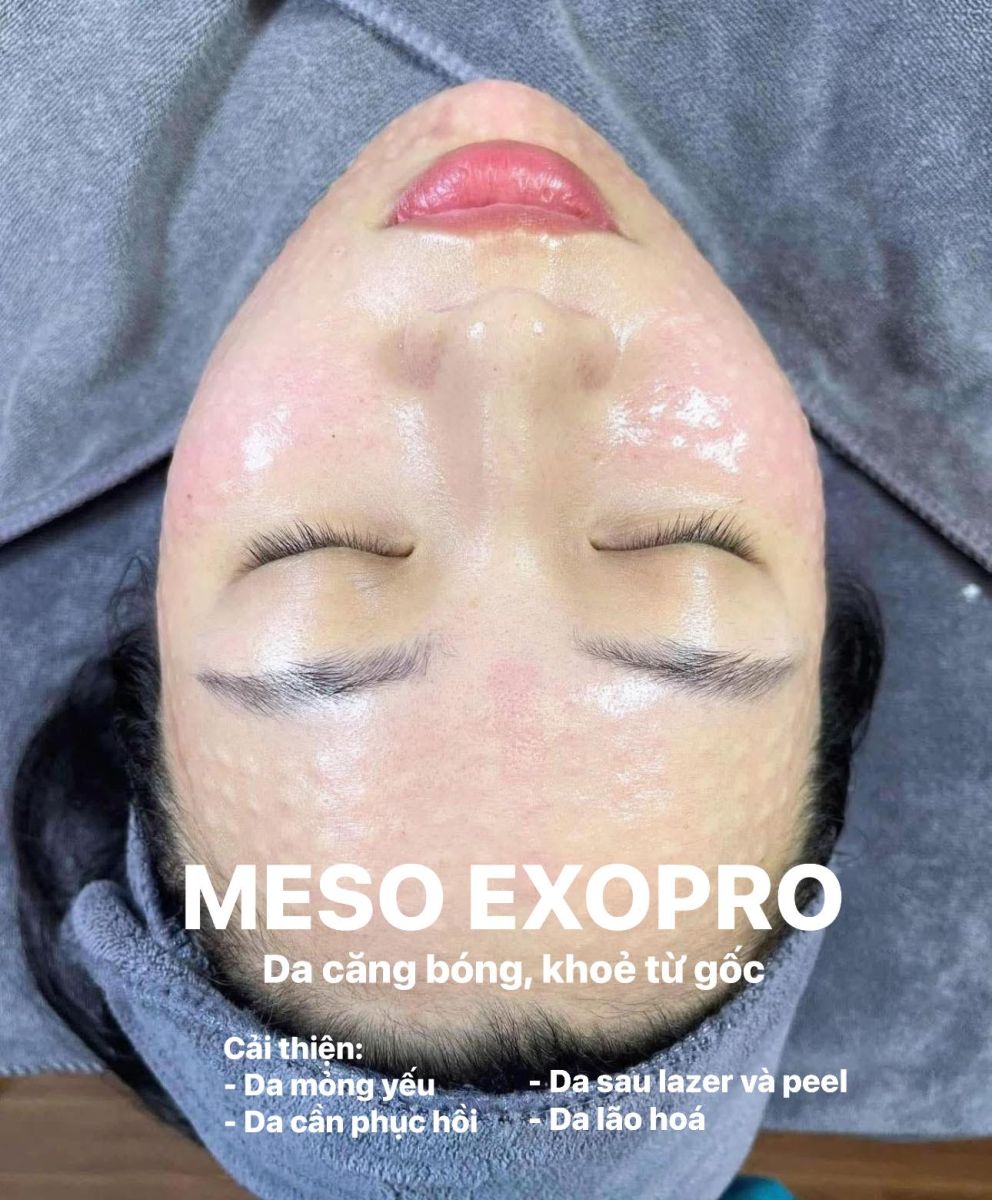 meso therapy