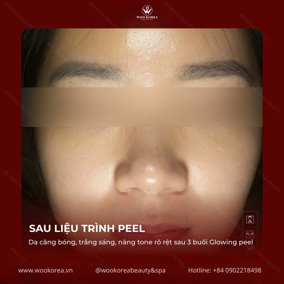 peel da