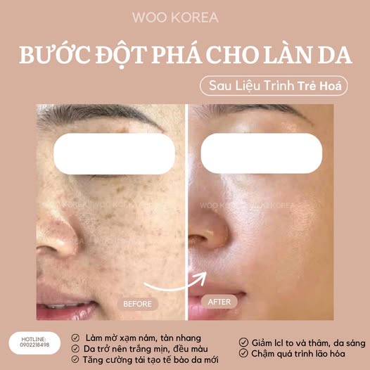trẻ hóa da